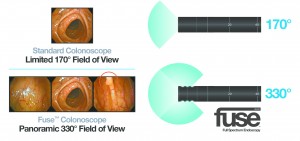 Innovative Full Spectrum Endoscopy Procedure