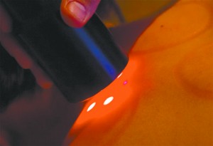 Low Level Laser Therapy