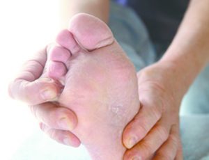 Dry Skin or Athlete’s Foot? Diabetic Patients, Beware!