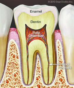 The Process of Root Canals Explained