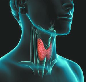 THYROID CANCER INCIDENT RATES ON THE RISE