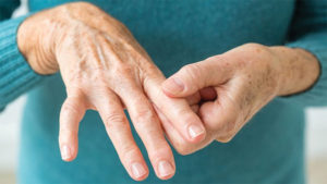 Do You Have Rheumatoid Arthritis