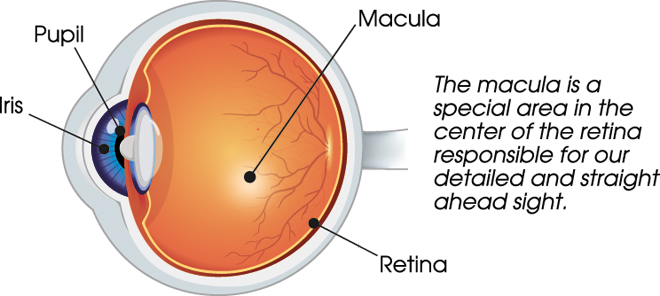Age-related Macular Degeneration A Common Cause of Vision Loss