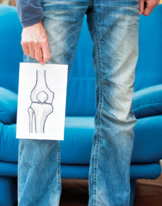 Arthritis: Do You REALLY Need Knee Replacement Surgery?
