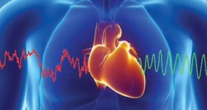 HEART RATE VARIABILITY IS THE KEY  MEASUREMENT FOR OPTIMAL HEALTH 