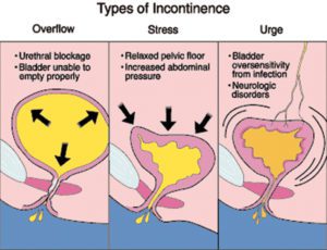 Stop Overlooking Signs of Incontinence