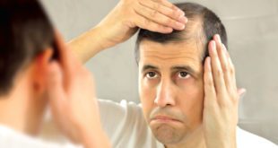 Learn The Bald Truth About Hair Loss