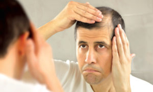 Learn The Bald Truth About Hair Loss