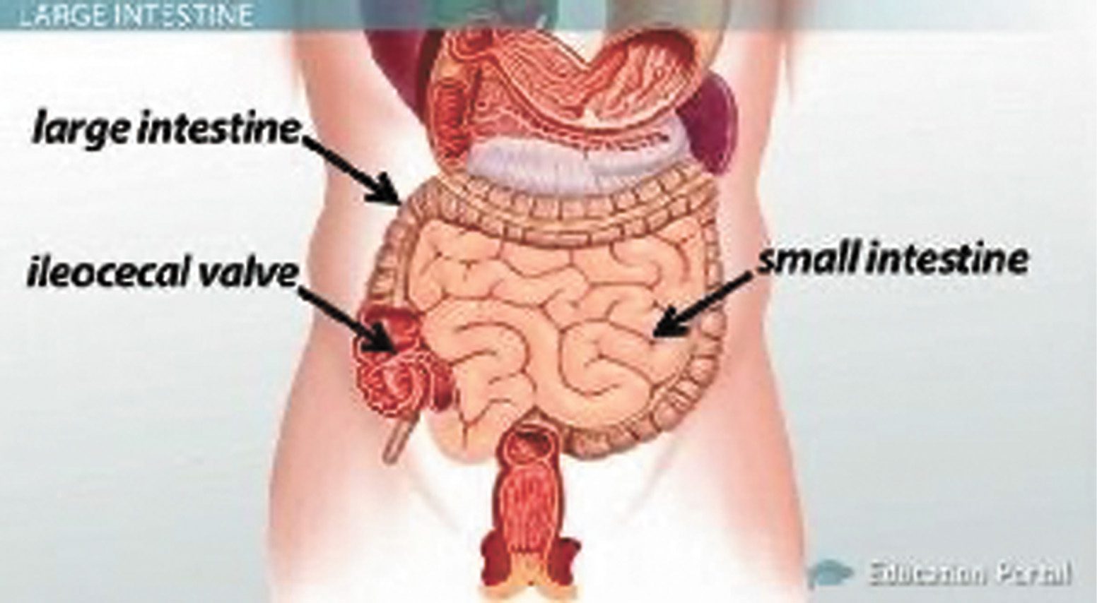 Weightlifter Loses Intestines