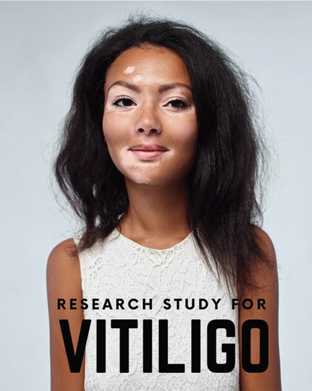 Vitiligo Awareness Month Central Florida Health and Wellness Magazine