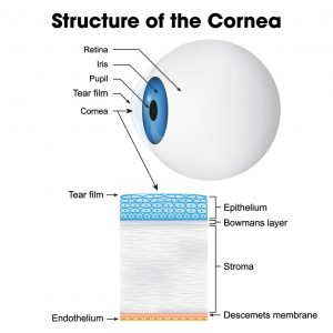 Cornea Conditions