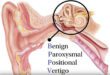 Vestibular Balance