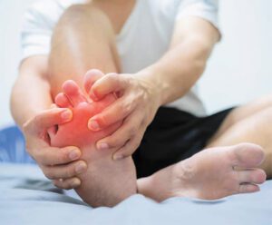 Flare-Ups of Gout