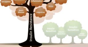 Insulin Resistance and Obesity