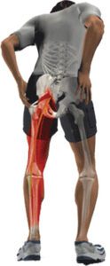 Back Pain