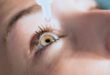 EYE ALLERGIES