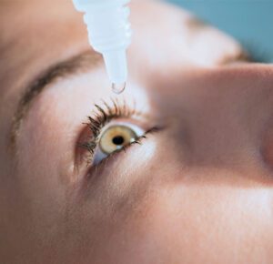 EYE ALLERGIES
