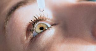 EYE ALLERGIES