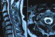 Understanding Your MRI Report