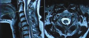 Understanding Your MRI Report