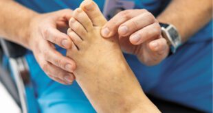 Diabetic Foot Ulcers