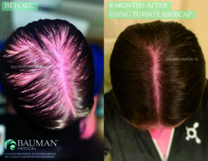 hair for the holidays