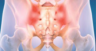 Chronic SI Joint Pain
