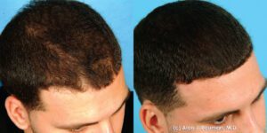 Bauman Medical Helps Men Get Their Swagger Back