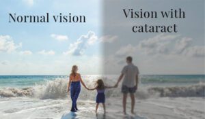 Seeing Clearly